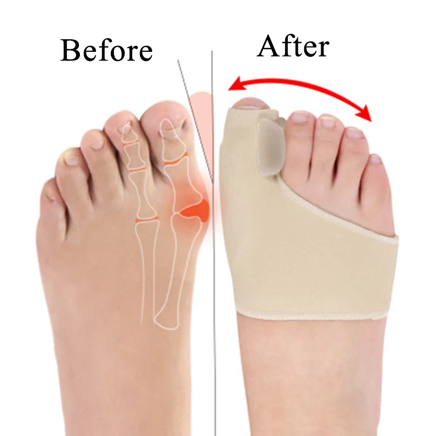 

1Pair Big Bone Orthopedic Bunion Orthosis Pedicure Socks Silicone Hallux Valgus Corrector Braces Toes Separator Feet Care