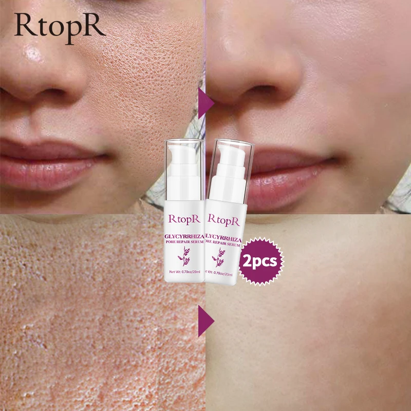 2 шт. отбеливающий крем для лица от морщин | Красота и здоровье