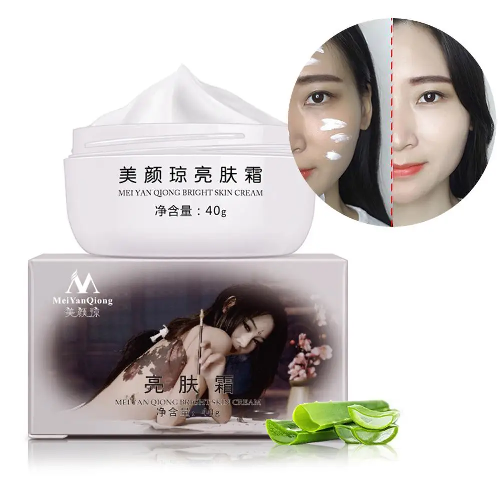 

40g Strong Effects Whitening Cream Remove Melasma Acne Spots Pigment Melanin Sunburn Pregnancy Spots Face Care Cream