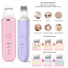 Ультразвуковой очиститель для кожи, шпатель для вибрирования лица, лопатка для удаления черных точек, кавитационный пилинг, лифтинг кожи, уход за кожей