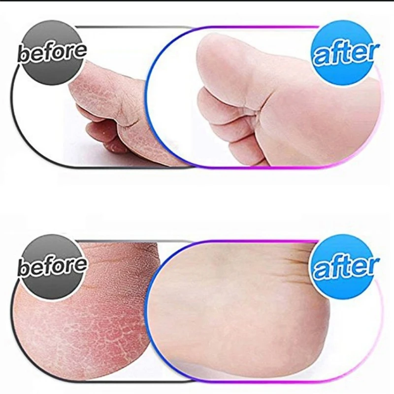 

15 Packs of Blue Replacement Rollers for Amope Pedi Refills Compatible with Wet and Dry Electronic Perfect Foot Files