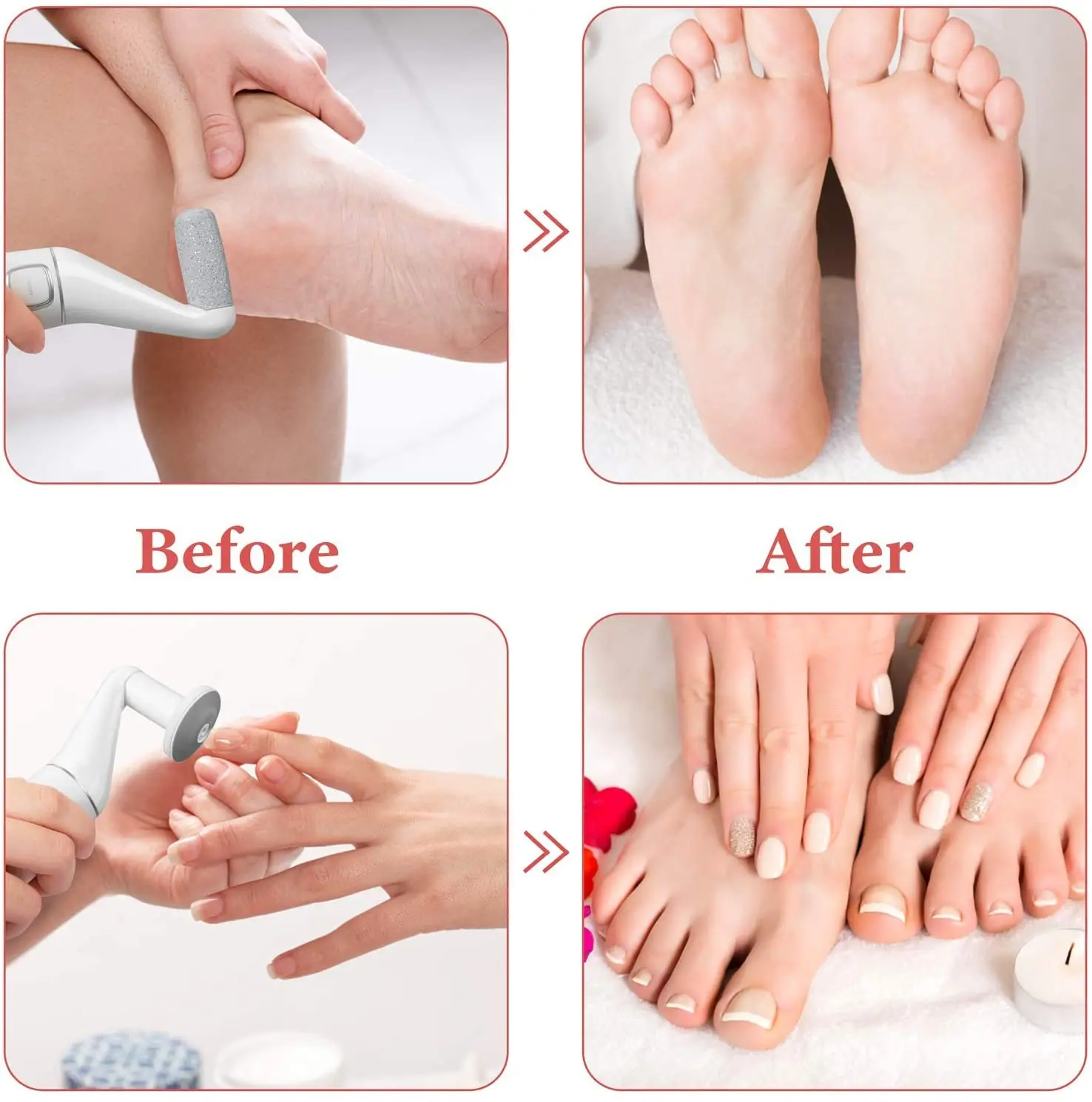 

Electric Foot File Callus Remover Machine Pedicure Device Foot Care Tools Feet For Heels Remove Dead SkinFoot repair tool Silver