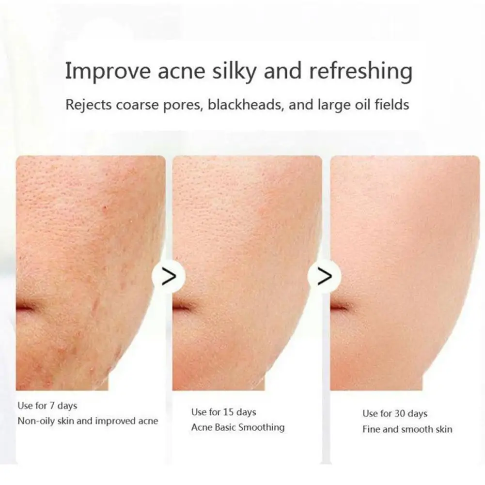

Vova Retinol Face Wash Soap Collagen Face Cream Anti Pores Wrinkle Anti Moisturizing Skin Aging Shrink Care Firm Lifting S4x0