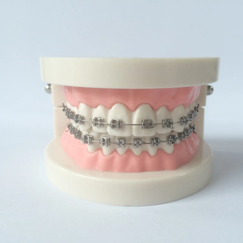 Стоматологическая Ортодонтическая модель с кронштейнами | Красота и здоровье