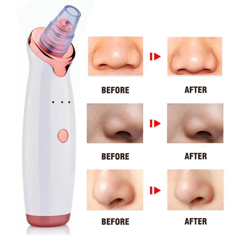 Пылесос женский/мужской для удаления черных точек | Красота и здоровье