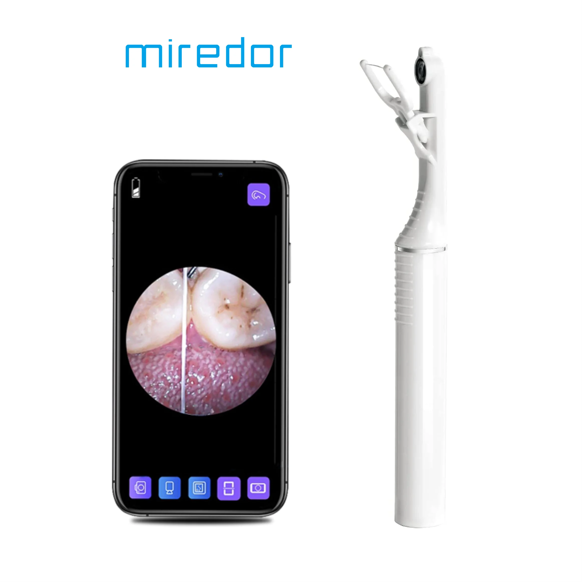 Miredor Intelligent Vision Dental Floss, Visualization Care Teeth Cleaner With Free 50 Replaceable Floss & 20 Cleaning Cotton Pad