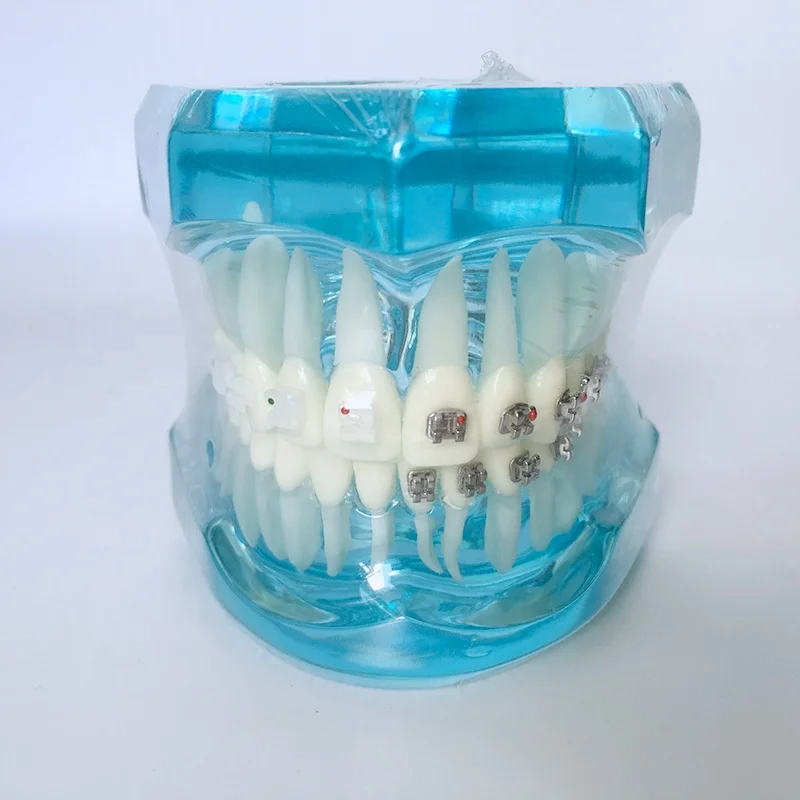 

Teeth Teeth Study Model M3003 Orthodontics Model with Metal and Ceramic Bracket