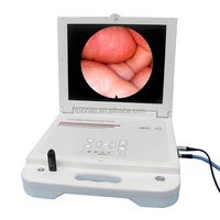 lhgw611 portable medical monitor led light source ent ccd endoscope camera portable endoscopy unit