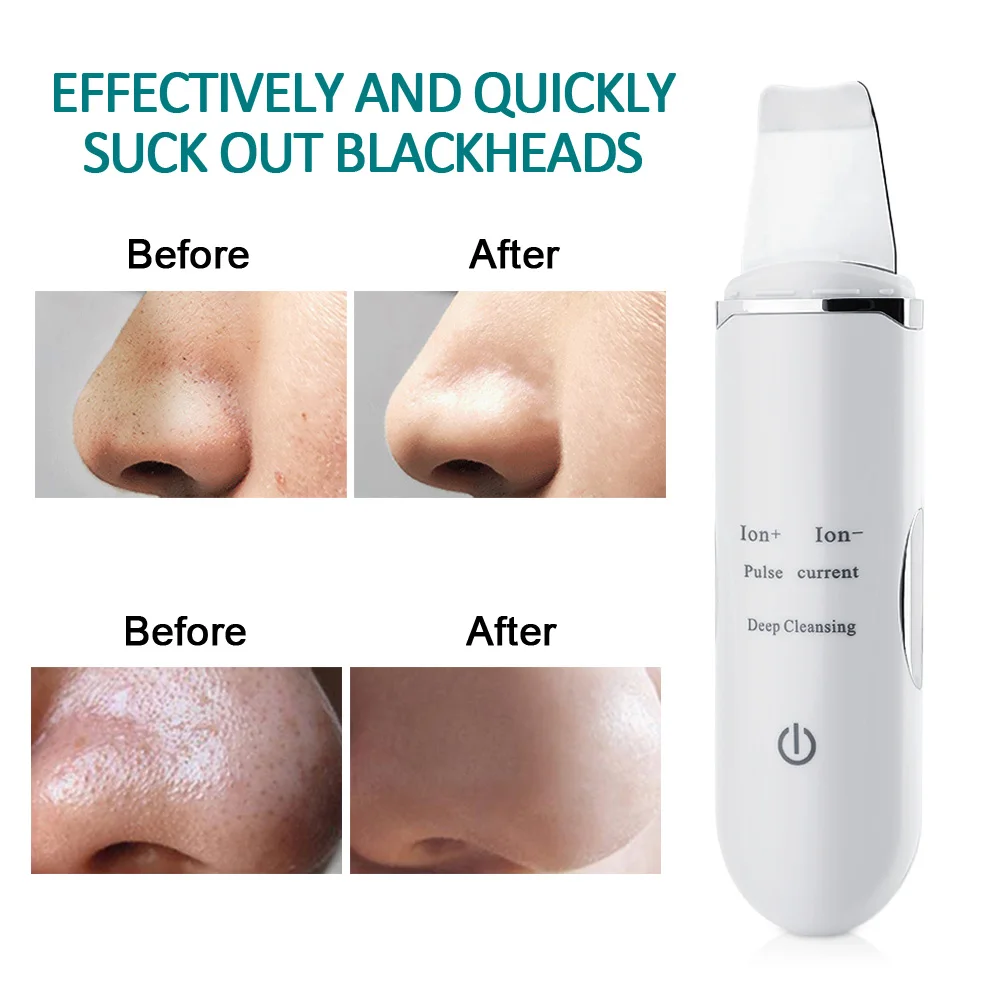 Прыщей Blackhead удалить ультразвуковой скребок для лица поры акне очищающий