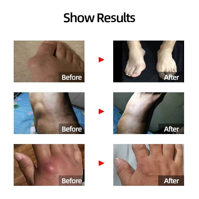 Китайская травяная медицина баланс мочевой кислоты в крови чай для лечения