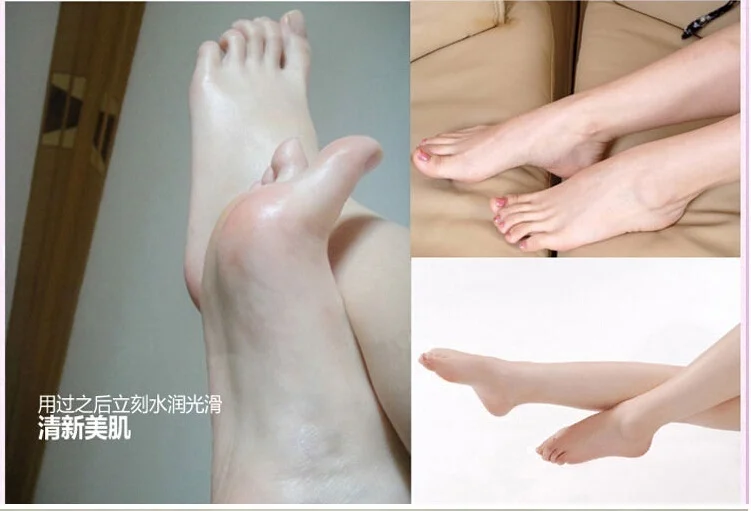 Новейшая модель омертвевшие чешуйки кожи и снятия с рисунками бабочки пилинг