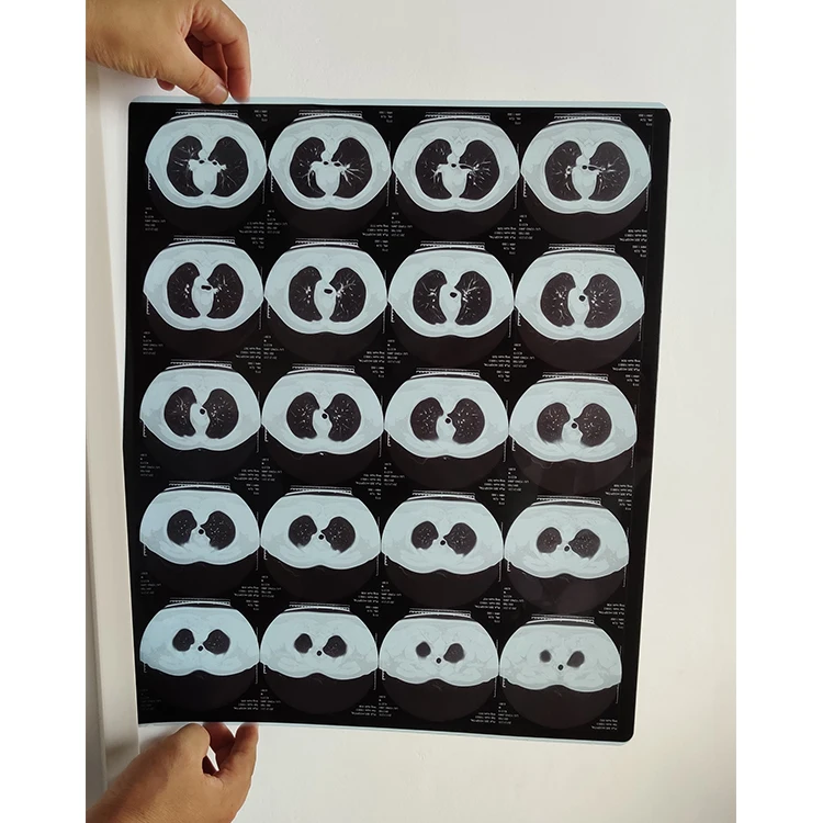 

Medical X-Ray film dry film for agfa printer drystar 5302 5503 dt2b dt5b dt10b and Fuji 3500/2000/Liter Printer