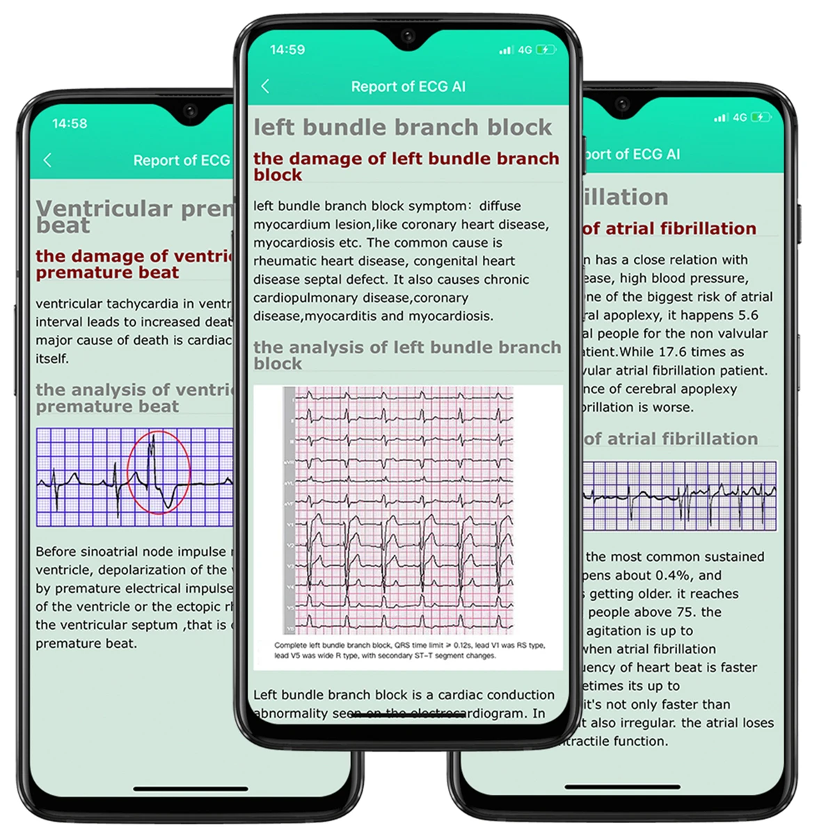 men ppg ecg smart watch with body temperature heart rate blood pressure monitor smartwatch 1 7inch full touch women sport watch free global shipping