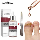Жидкость LANBENA для восстановления ногтей, удаление грибка ногтей, против онихомикоза, уход за ногами, лечение с пилкой для ногтей, жидкость для восстановления ногтей TSLM1