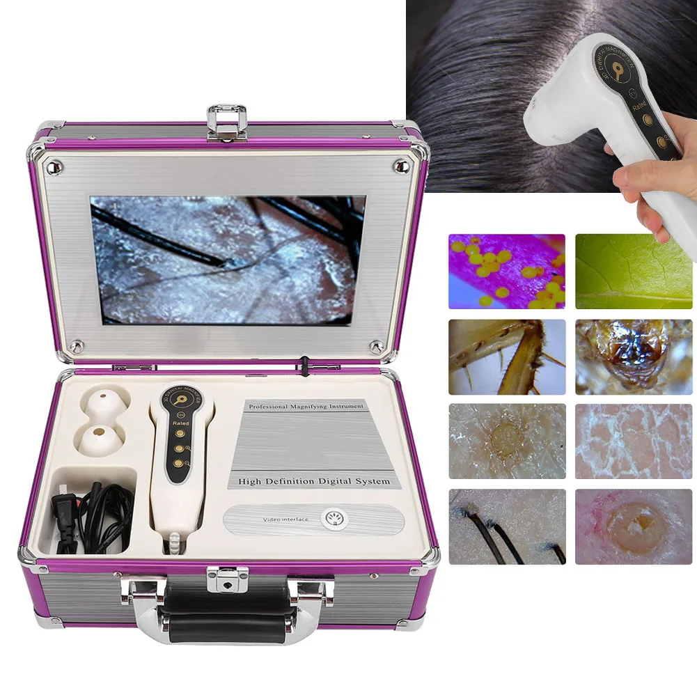 Профессиональный внешний вид устройство обнаружения волос головы волосяной