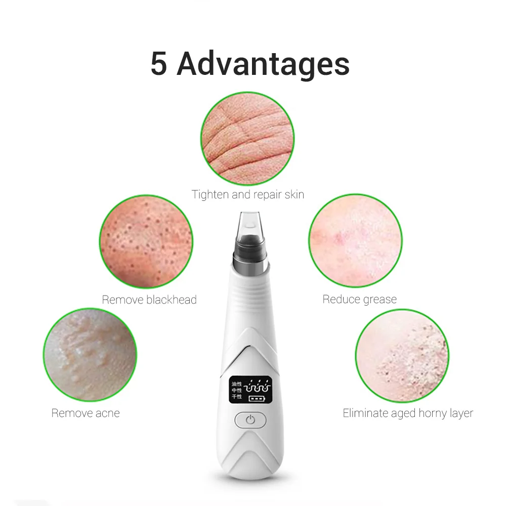 Вакуумный отсос угрей для удаления пор носа и лица средство прыщей с Черной