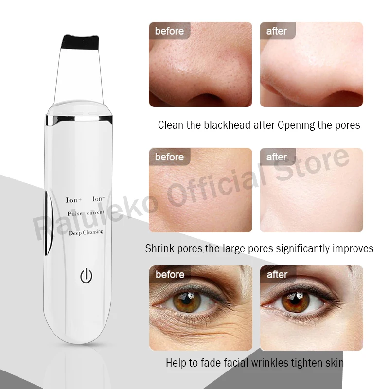 Ультразвуковой очиститель пор отшелушивающее средство для удаления черных