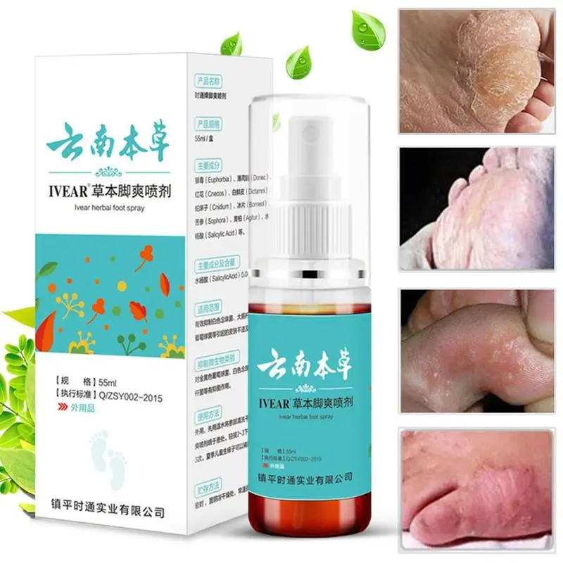 Foot odor, sweaty foot cream treatment of peeling and erosion-type feet soaking and sweating feet spraying water for exfoliating