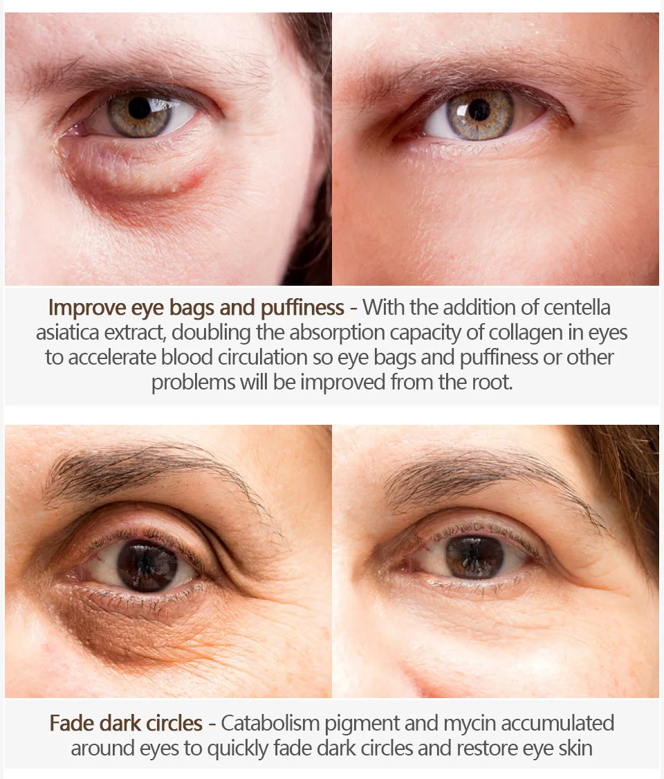 

Eye Cream Peptide Collagen Serum Anti-Wrinkle Anti-Age Remove Dark Circles Eye Care Against Puffiness And Bags Hydrate Eye Cream