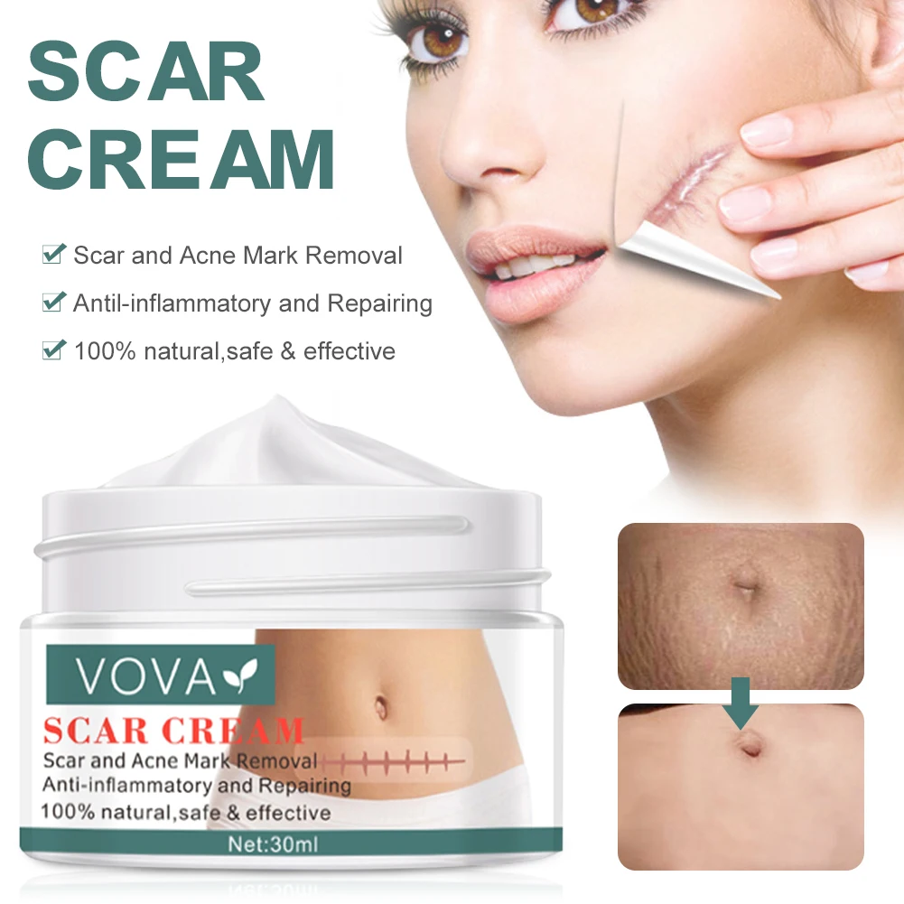 

30ml Acne Scar Removal Cream Pimples Stretch Marks Face Gel Remove Acne Smoothing Whitening Moisturizing Body Skin Care