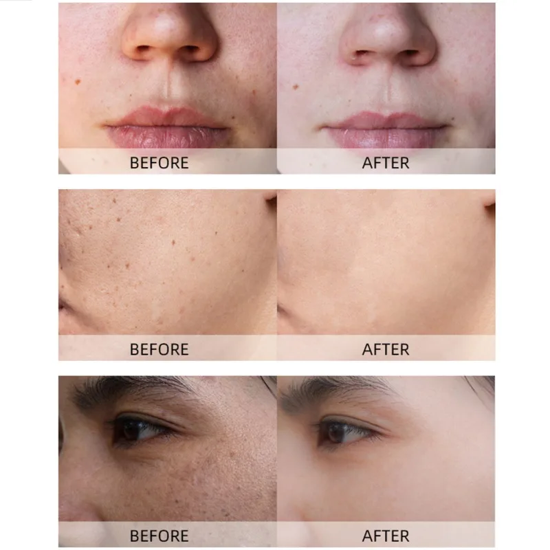 

Peeling Acne Blackhead Treatment Mask Remover Contractive Pore Whitening Hydrating Care Mud Ginger Face Cleansing Mud