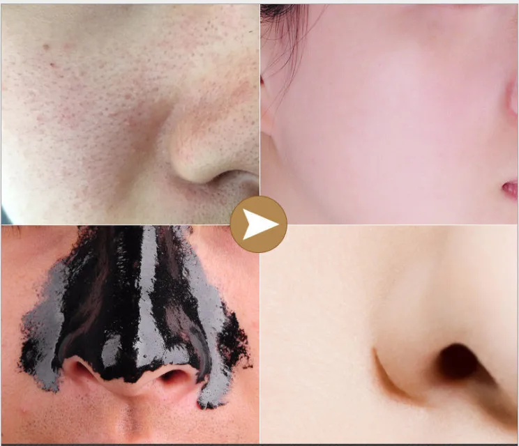 Маска для удаления черных точек маска лица 60 г лица|Средства ухода и маски| |