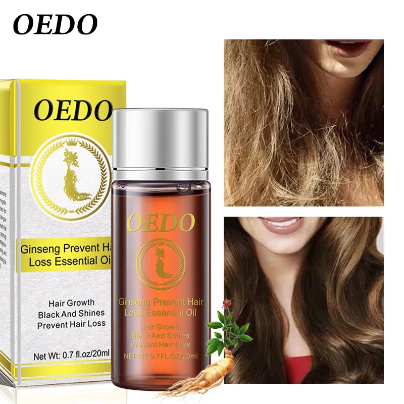 3 шт. быстрая эфирное масло для роста волос вылечит вас от облысения помогает