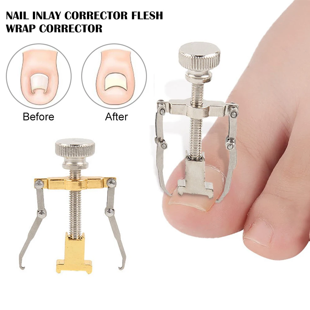 

1Pc Ingrown Toenails Correction For Pedicure Toe Care Straightening Clip Brace Corrector Ingrown Toe Nail Fixer Feet Care Tools