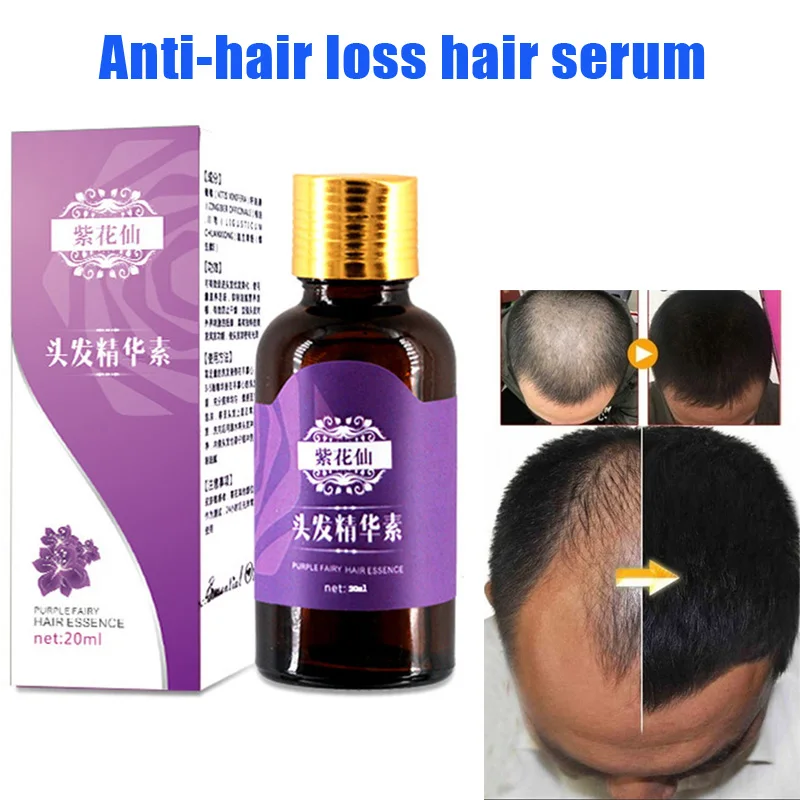 

Hair Care Essence Prevention Hair Loss Effective Growth Nourishes Oil Control MH88