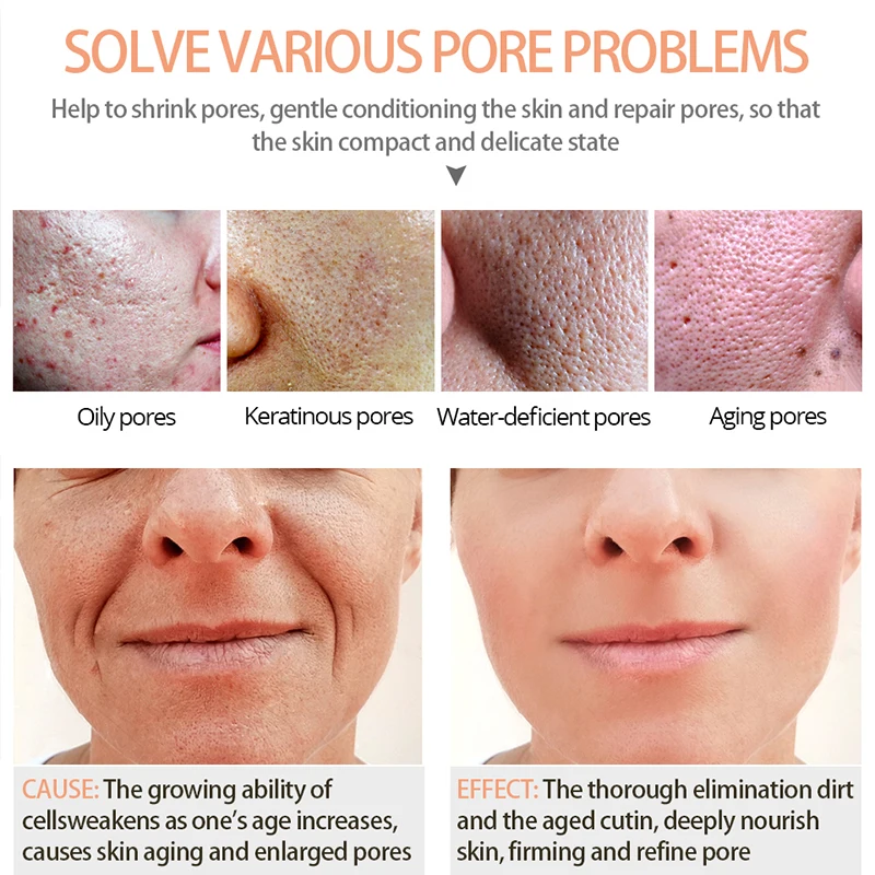 Hyaluronic Acid Shrink Pores Face Serum Liquid Moisturizing Essence Plant Skin Care Anti Wrinkle Whitening | Красота и здоровье