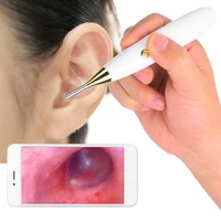 wifi visual otoscope medical 1280x720 ear inspection camera 1mp endoscope camera ear wax cleaning tool for iphone android phone