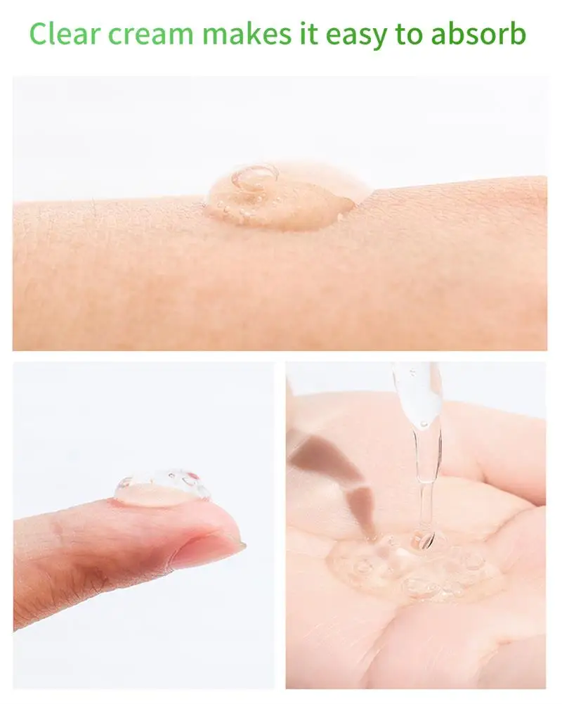 LANBENA Сыворотка для лица Удаляет угри сужает поры пилинг лечение акне очищающая