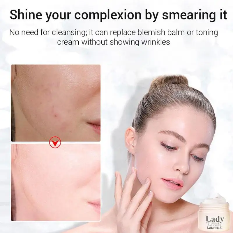 Отбеливающий крем для лица против веснушек натуральная растительная формула