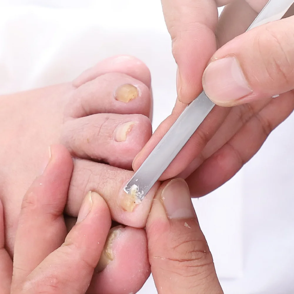 

Manicure Remover Nail Cream Manicure Set Paronychia Nail Infection (Silver)