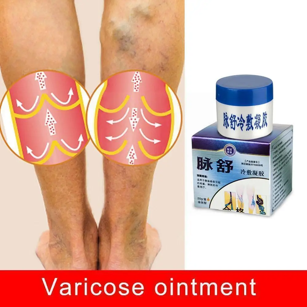 

Herbal Medicine For Treating Varicose Vasculitis Phlebitis Spider Legs Veins Pain Massage Cream Treat Varicose Vein Ointmen G8H8