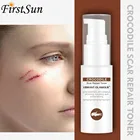 Ремонт шрамов эссенция для удаления рубцов от акне отметок корректор пигментации скальдного шрама уход за телом крокодил Тоник для лица