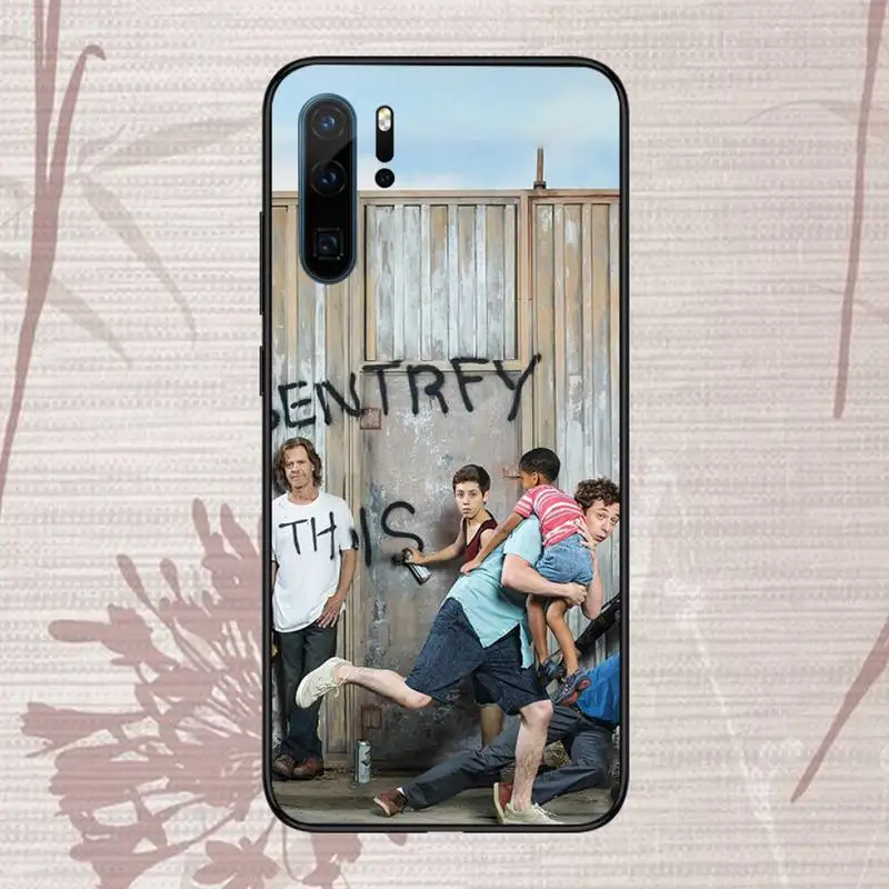 

Lip Gallagher Shameless tv show Phone Case For Huawei P20 P30 P40 lite Pro P Smart 2019 Mate 10 20 Lite Pro Nova 5t
