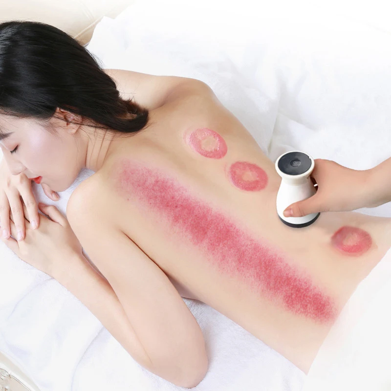 Электрический массажер для похудения Guasha Cupping традиционная китайская терапия