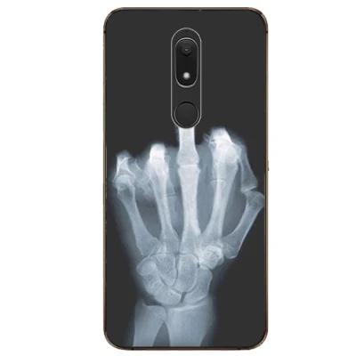 For Multilaser MS80 Case 5.7&quot Luxury TPU Silicone Cases for Phone Back Cover MS 80 Funda Coque | Мобильные телефоны и