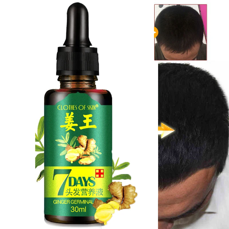 

Эфирное масло имбиря, эссенция для роста волос, Жидкость против выпадения волос, 30 мл, эссенция для роста волос, густые волосы, быстрый рост