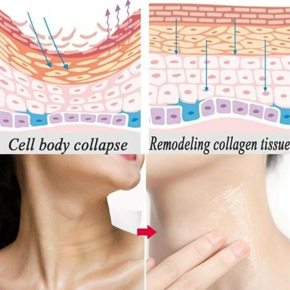 

Six Peptides Serum Liquid Hyaluronic Acid And Anti-wrinkles Whitening Collagen Face Lift Skin Care Cream