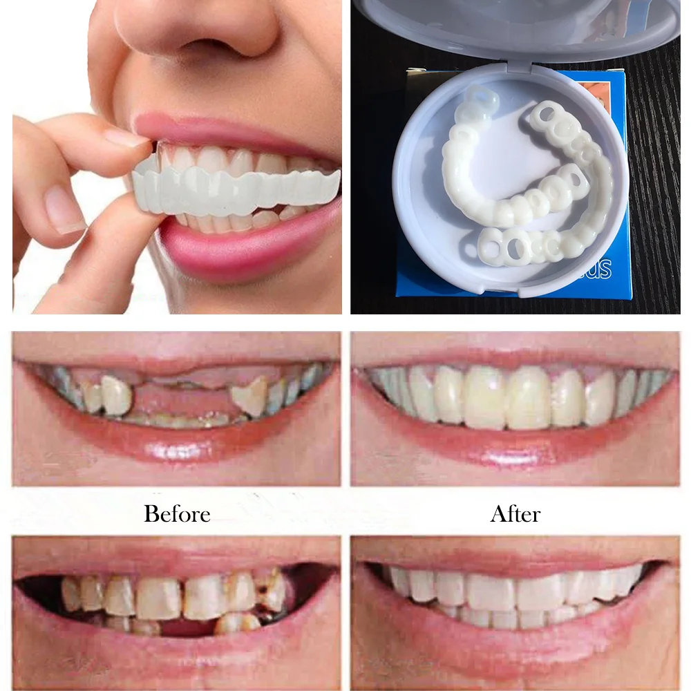 Верхние и нижние виниры накладные зубы нетоксичные практичные пластиковые для