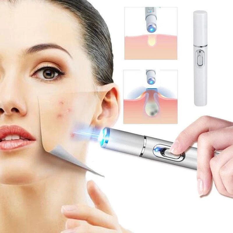 KD-7910 синий светильник лазерная терапия ручка для удаления шрамов акне против