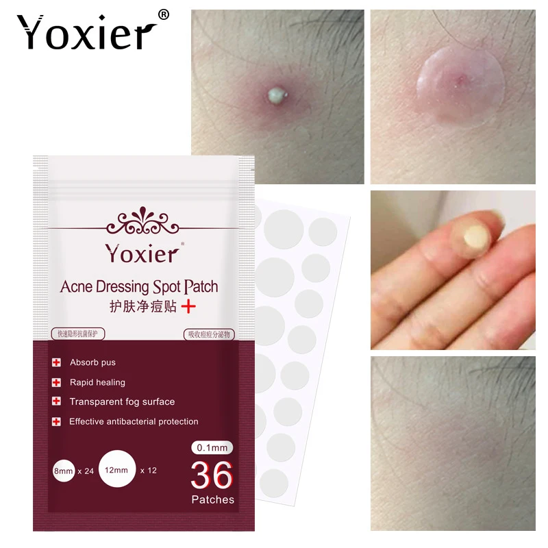 36pcs/sheet Skin Tag Remover Pimple Master Patch Treatment Invisible Acne Stickers Patch Acne Concealer Tags Makeup Tools TSLM1