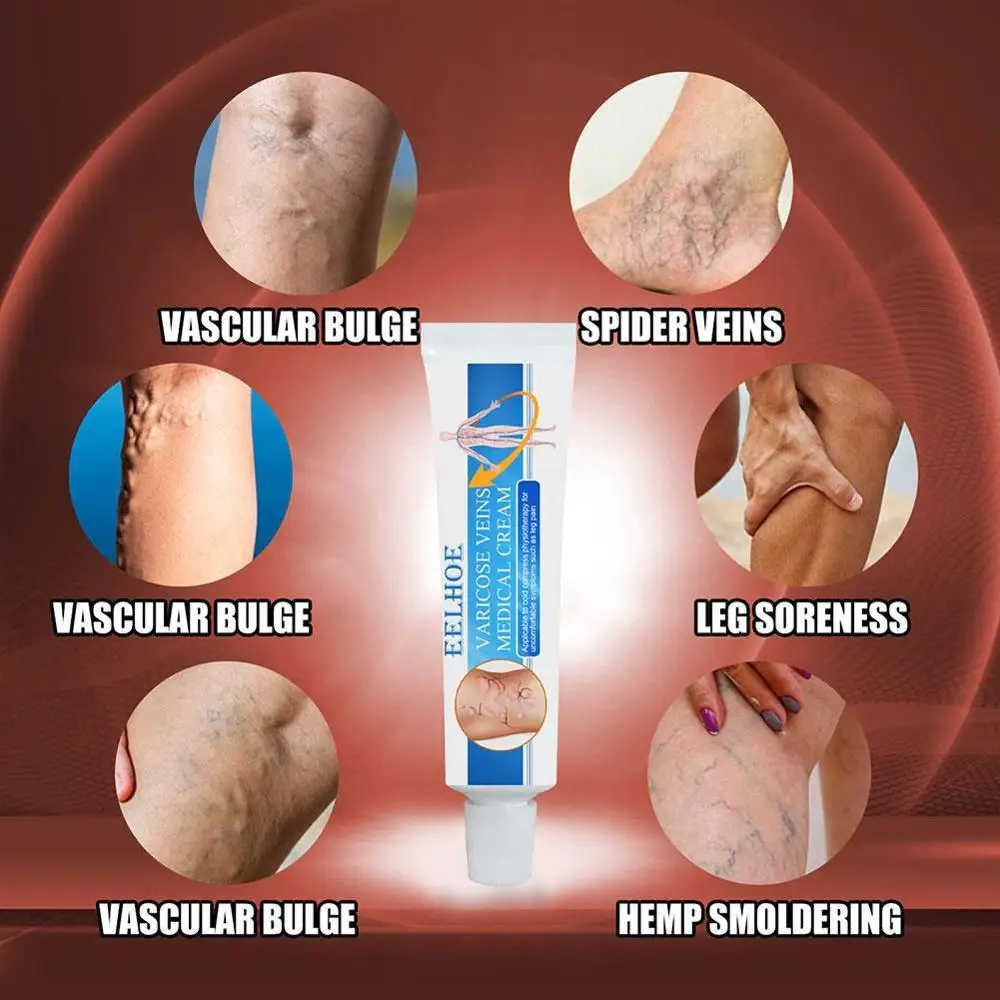 

16g Varicosity Medical Varicose Veins Cream Treatment Leg Herbal Massager Anti Foot Product Phlebitis Vasculitis Foot L3V1