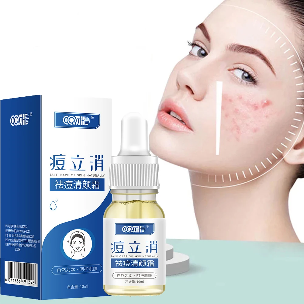 

Effective Acne Removal Serum Acne Treatment Fade Acne Spots Oil Control Shrink Pores Moisturizing Acne Essence Skin Care