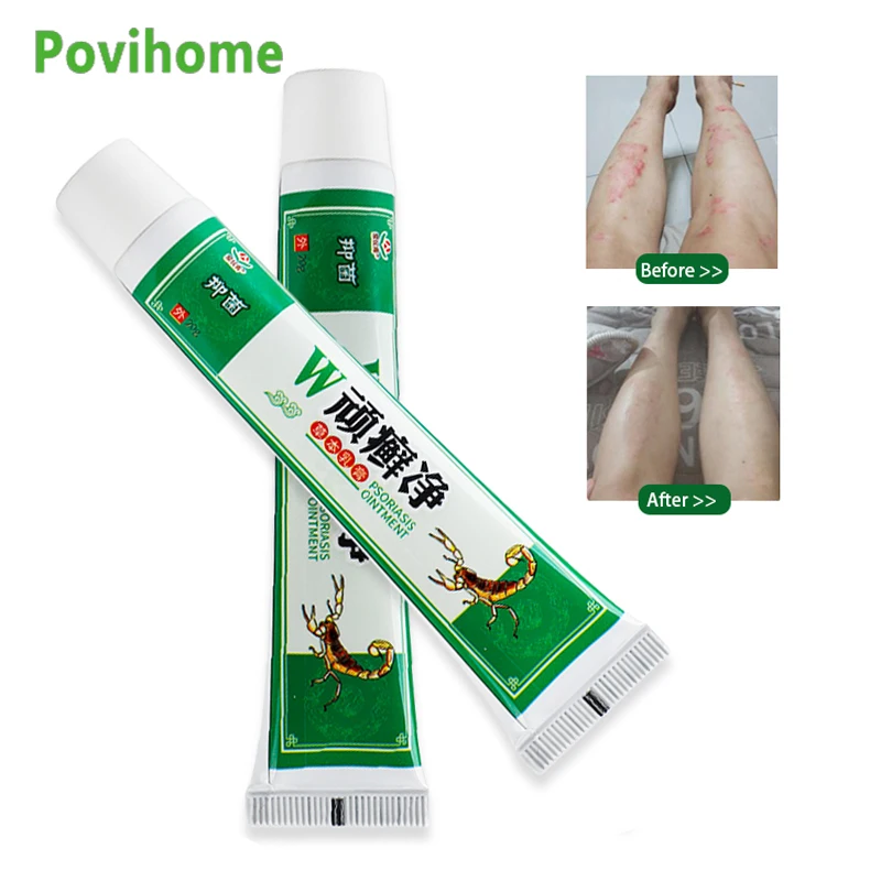 

1 шт., антибактериальный крем для лечения кожи скорпиона, экземы псориаз