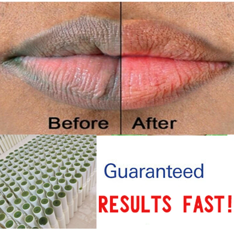

Of Lips Pink Fresh Lightening Bleaching Cream Treatment Remove Dark Smoke Lips oil Moisturizing Prevent chapped