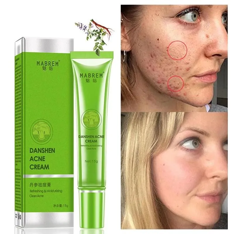 

Pure Plant Extraction Acne Removal Cream Fade Acne Spots Oil Control Shrink Pores Whitening Moisturizing Acne Cream Face Care