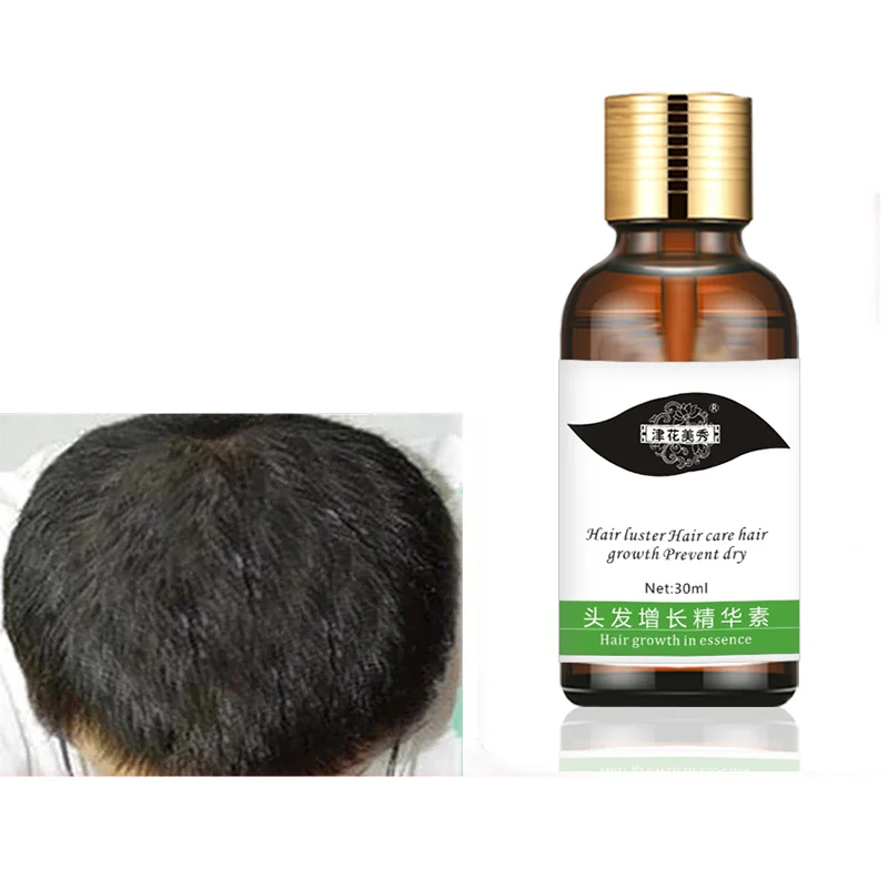 1pcs Fast Hair Growth Essence Hair Loss Products Hair Growth Fibras Cabelo Shampoo Cremes De Tratamento Para Cabelos Hair Care